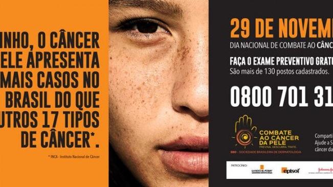 Em 29 de novembro, exames marcam o Dia Nacional de Combate ao Câncer de Pele